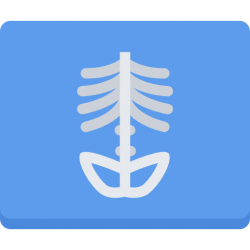 مراكز الاشعة بسوهاج 2 x ray e1542110588919